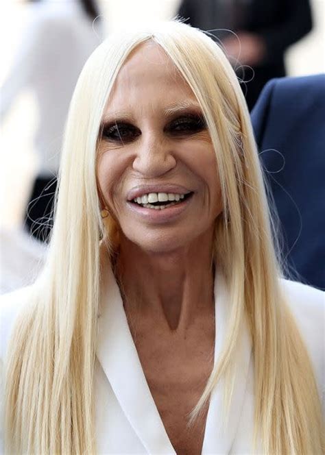 what happened to donatella versace's face.